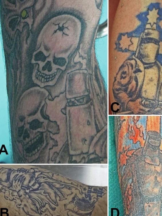 Examples of Ned Kelly tattoos. Picture: Roger W. Byard & Hamish Maxwell-Stewart