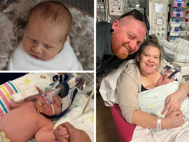 A two-month old baby boy is undergoing chemotherapy after he was diagnosed with a rare cancer in his mother’s womb.