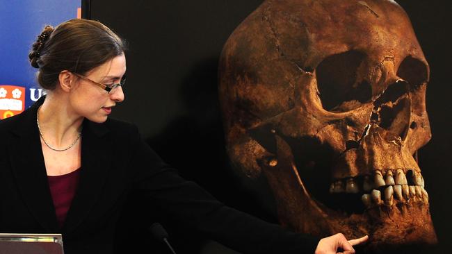 ‘What fascinated me was his death’ … a slide depicting the skull of King Richard III during a discussion by Jo Appleby, a lecturer in Human Bioarchaeology, at University of Leicester.