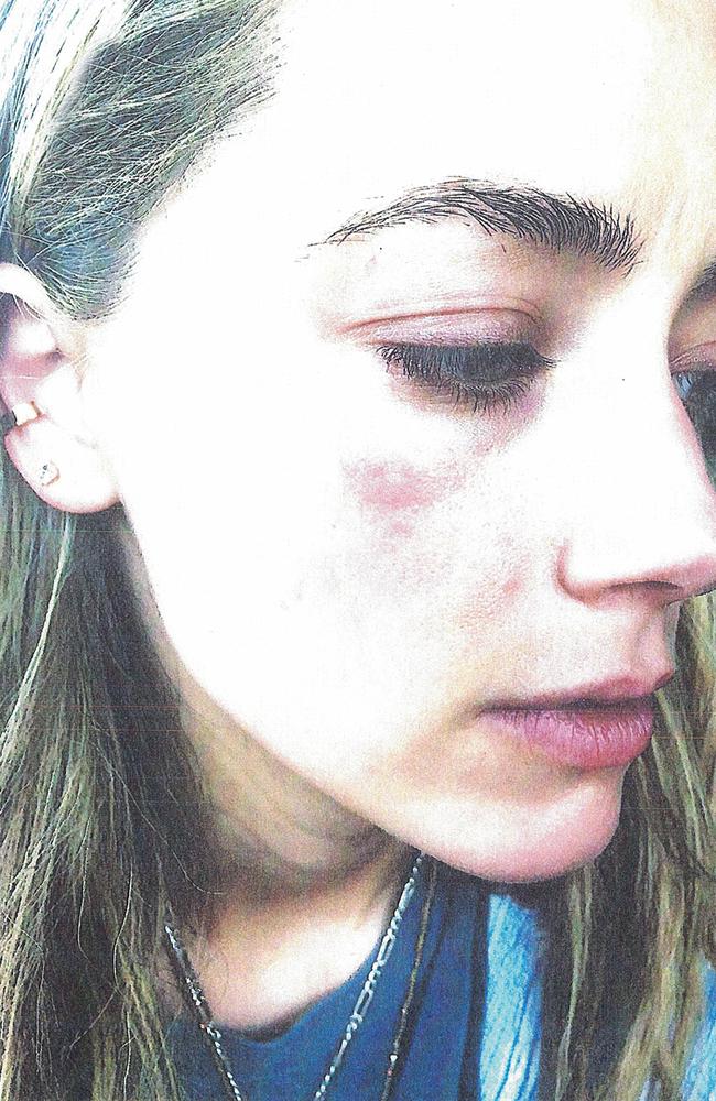 Heard is accusing Depp of domestic violence.