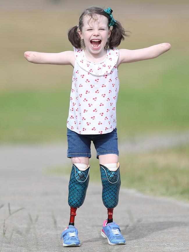 Mia Wilkinson is ecstatic with her new prosthetic legs.