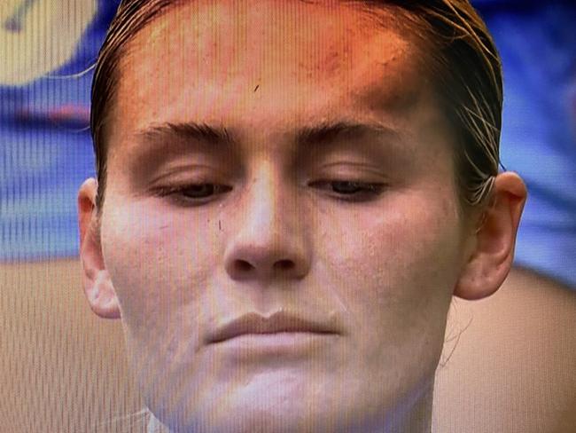 Melbourne City's Taylor Otto with a huge bump on her head after a serious head clash with her team mate in the Round 5 A-League's Women's game. Photo: 10/Paramount+