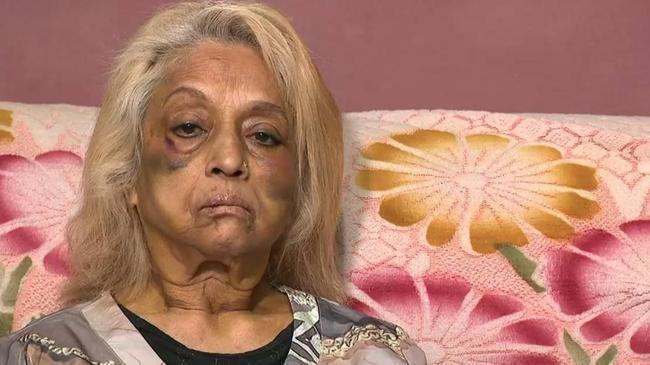 Ninette Simons, the victim of an assault and burglary in the Perth suburb of Girrawheen