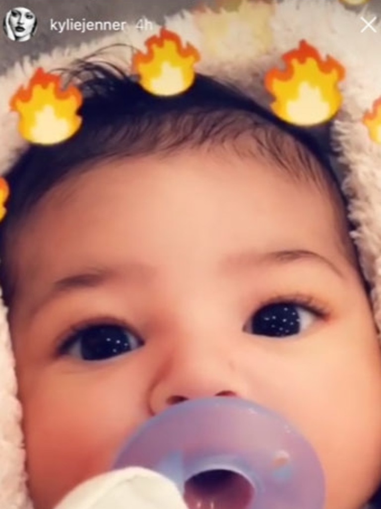 Kylie Jenners Daughter Stormi Hospitalised For Allergic Reaction