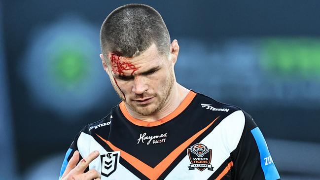 GOSFORD, AUSTRALIA - JULY 20: John Bateman  of the Tigers with a cut to his head during the round 20 NRL match between South Sydney Rabbitohs and Wests Tigers at Industree Group Stadium, on July 20, 2024, in Gosford, Australia. (Photo by Mark Evans/Getty Images)