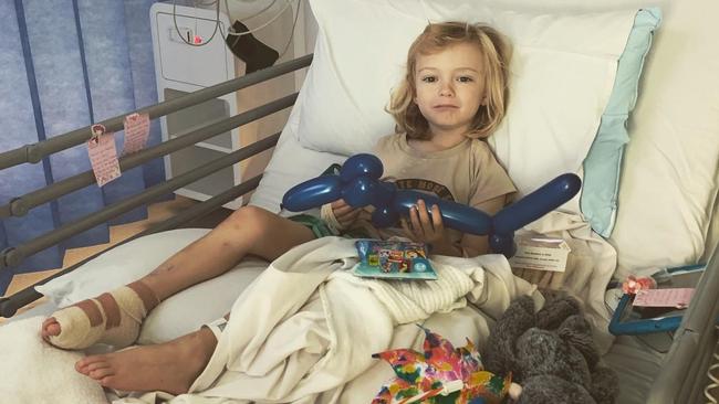 He was flown to Perth Children’s Hospital, but his toe couldn't be reattached.