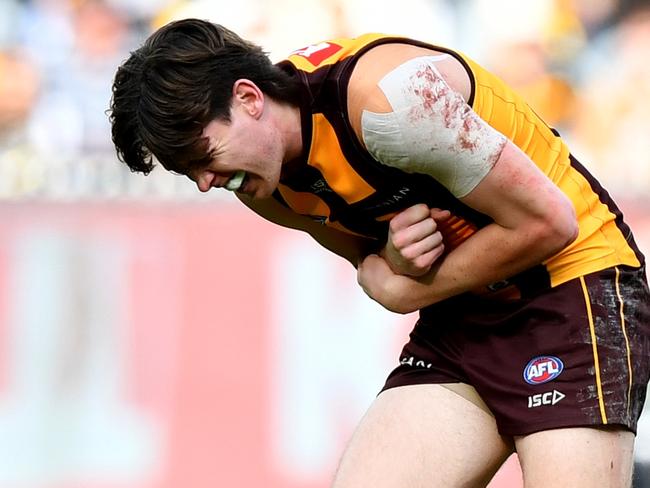 MELBOURNE, AUSTRALIA – AUGUST 18: Will Day of the Hawks receives medical attention during the round 23 AFL match between Hawthorn Hawks and Richmond Tigers at Melbourne Cricket Ground, on August 18, 2024, in Melbourne, Australia. (Photo by Josh Chadwick/AFL Photos/via Getty Images)