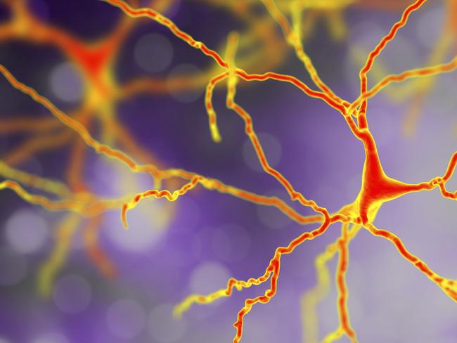 Dopaminergic neuron, computer reconstruction. Dysfunction of this brain cells are responsible for development of Parkinson's disease, autism and schizophrenia, 3D illustration