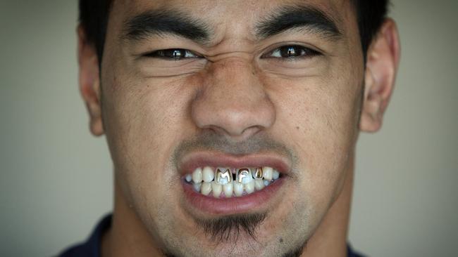 Melbourne Storm's Mahe Fonua, flashes his golden initials in his front teeth in adherence with Tongan tradition. The gold is from his fathers wedding ring