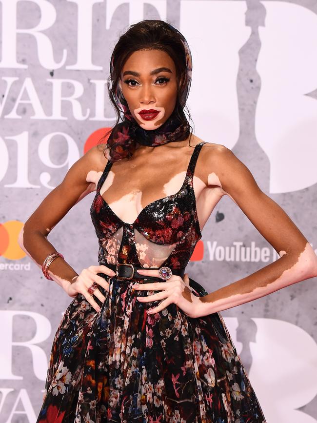 Winnie Harlow. Picture: Getty