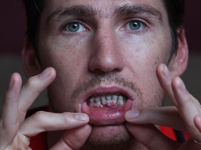 Perth Wildcats captain Damian Martin is recovering at home after surgery on his broken jaw from a clash in a game this week. Pictured with his dog Petey.