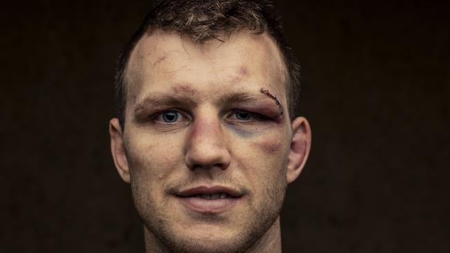 Boxer Jeff Horn the day after defeating Michael Zerafa in Brisbane. Picture: Glenn Hunt