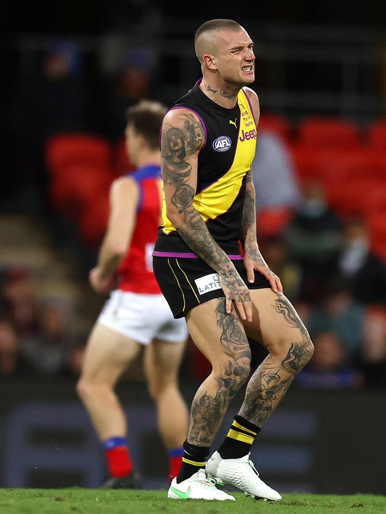 Martin grimaces as he comes from the Gold Coast field. Picture: Michael Klein