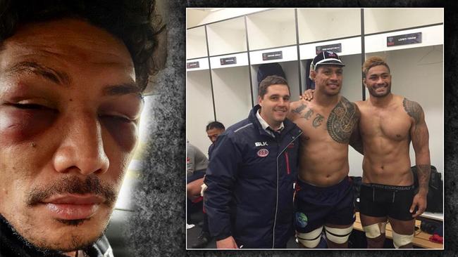 Lopeti Timani after the alleged attack by Amanaki Mafi, his Rebels teammate who he is pictured with alongside Rebels coach Dave Wessels.