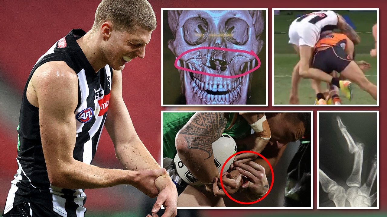 the-worst-afl-and-nrl-injuries-in-2020-the-courier-mail