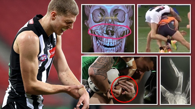 Worst AFL and NRL injuries in 2020