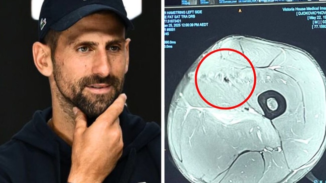 Novak Djokovic shared an MRI of his injured hamstring. Image: Getty/X