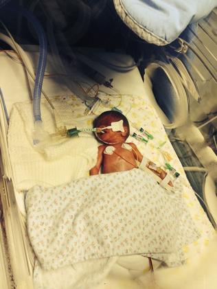 Ava weighed just 567 grams when she was born. Picture: Caters News