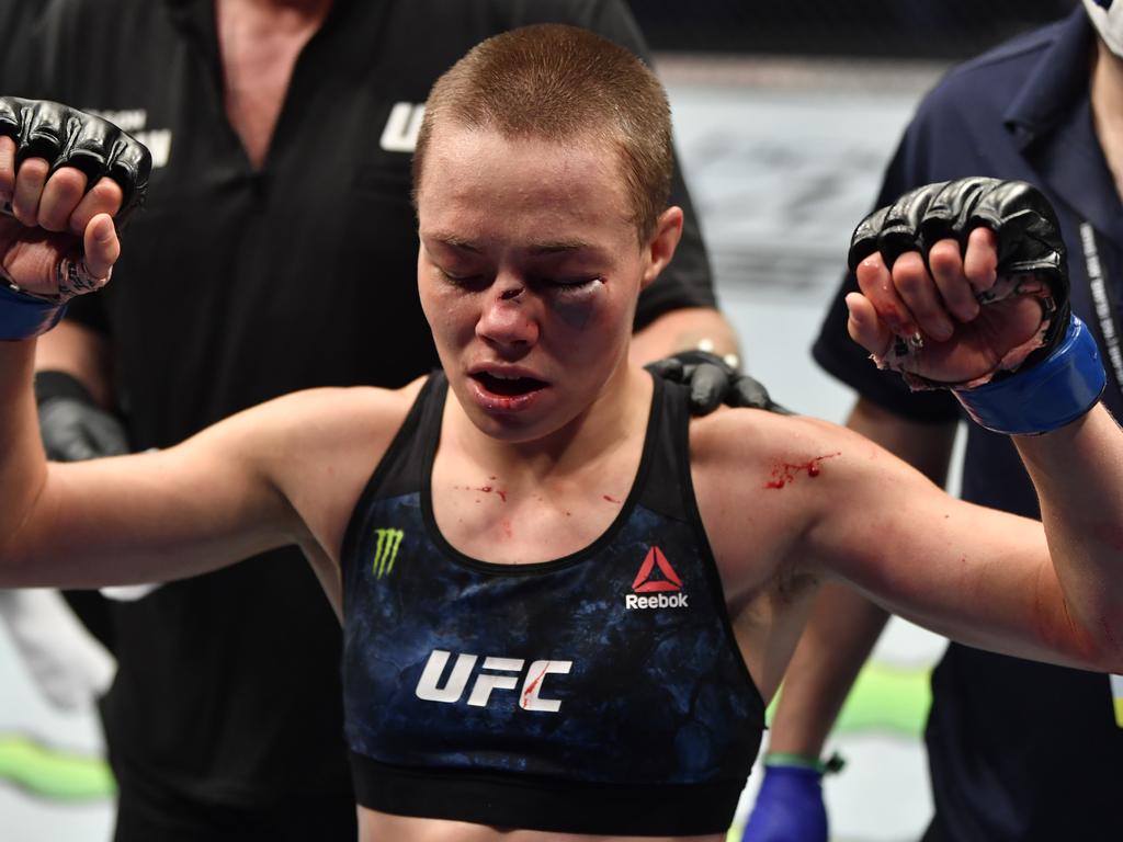 Rose Namajunas was cut up - but victorious. Picture: Getty