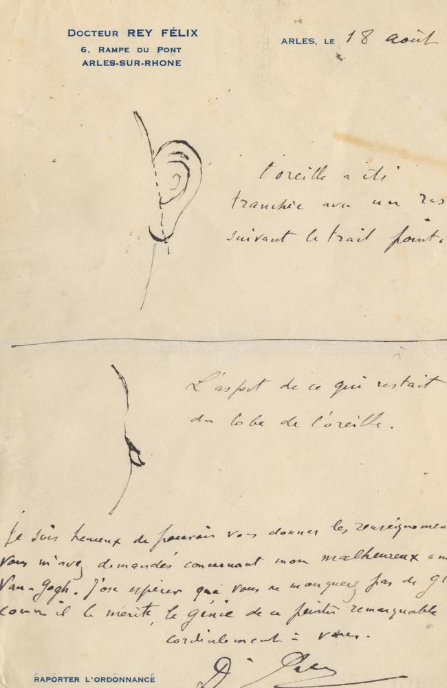 This sketch made by junior French provincial doctor Dr Felix Rey, who treated van Gogh, shows just how much off his left ear van Gogh sliced off in December 1888 in the southern French town of Arles. Picture: Van Gogh Museum via AP