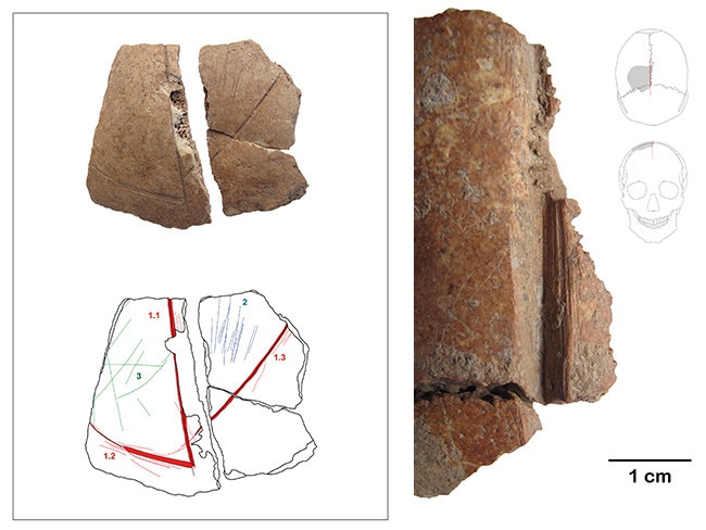 Images detailing skull fragments and the marks on them from the Göbekli Tepe skull study. Credit: Julia Gresky, Juliane Haelm, DAI.