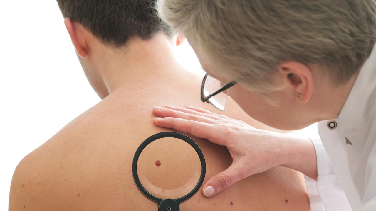 Thirty per cent of Aussies have never had a skin check, but two-in-three will develop skin cancer in their lifetimes.\