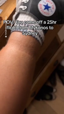 Aussie shocked by side effect from long flight