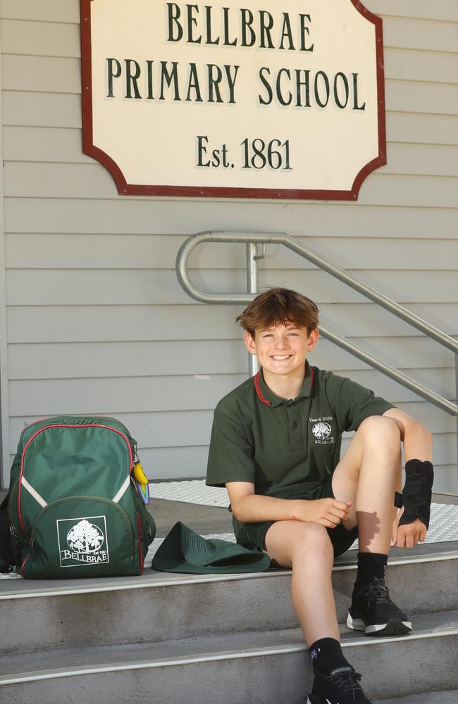 Freddie Price is finishing his Primary School journey the same way he started it – with a broken arm. Picture: Alison Wynd