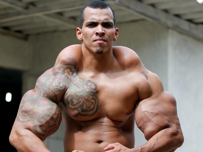 *** EXCLUSIVE - VIDEO AVAILABLE *** *** BRAZIL OUT *** CALDAS NOVAS, GO, BRAZIL - APRIL 04: Romario dos Santos Alves, a bodybuilding enthusiast, at his home on April 04, 2015, in Caldas Novas, Goias, Brazil. Bodybuilder Romario Dos Santos Alves modeled himself on the Incredible Hulk and risked his life injecting oil into his arms. The 25-year-old turned to a cocktail of oil, painkillers and alcohol to pump up his biceps - with astounding results. Now the former bodyguard terrifies children with his super-sized muscles and is facing a catalogue serious health issues. The married dad-of-one says his experiences of using the synthetic substance cost him his sanity and nearly his life and he was even scheduled to have his arms amputated. PHOTOGRAPH BY Pedro Ladeira / Barcroft Media (Photo credit should read Pedro Ladeira / Barcroft USA via Getty Images)