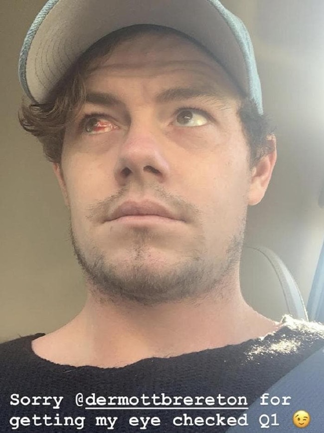 Lachie Neale was left with an injured eye after the clash with Port. Picture: Instagram/@LachieNeale