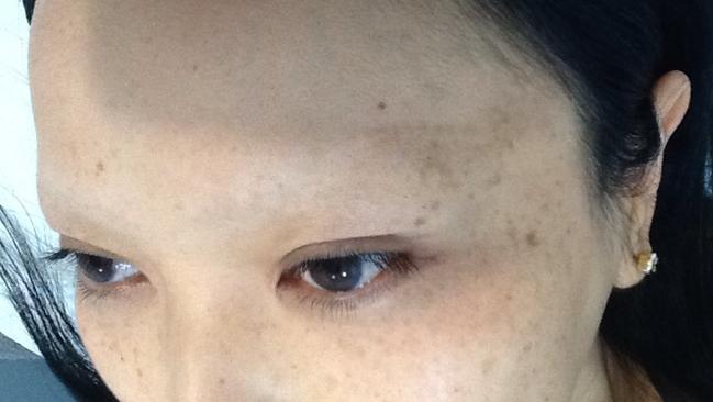 Kym's eyebrows after the successful laser tattoo removal.