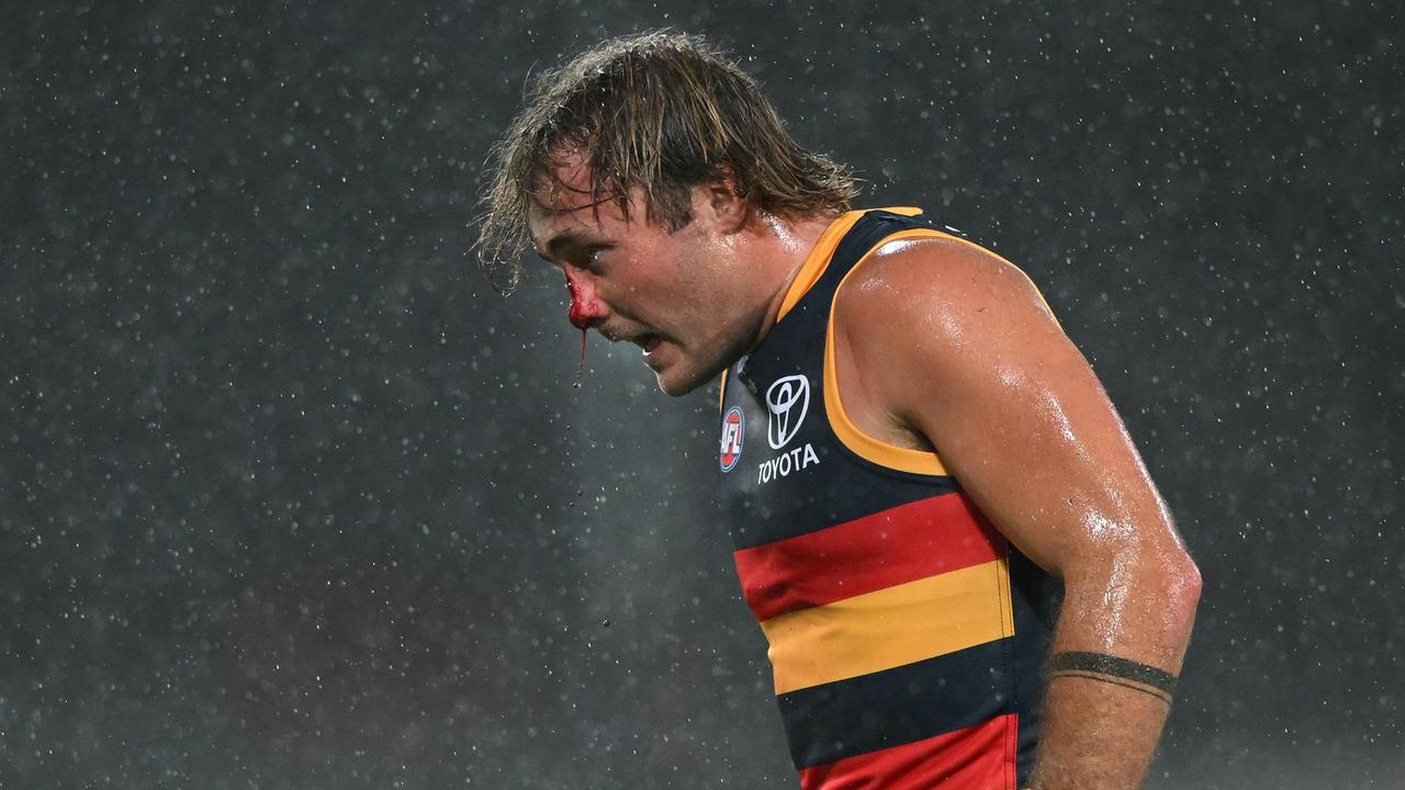 Luke Pedlar came off worse for wear. (Photo by Matt Roberts/AFL Photos/via Getty Images )