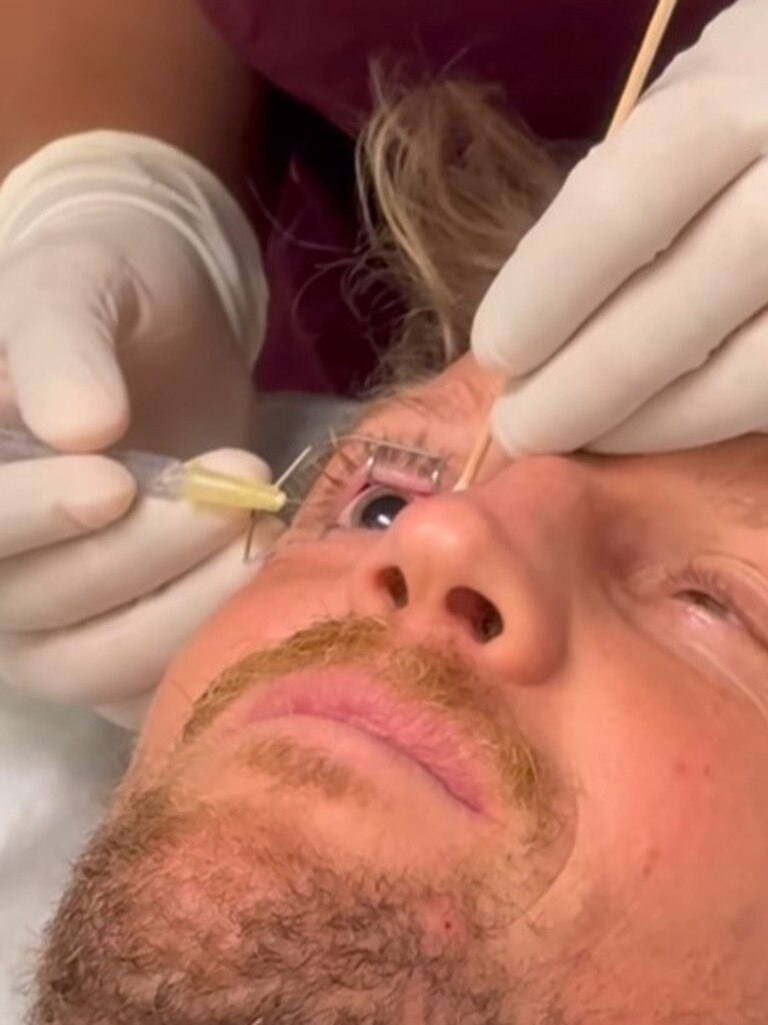 Rory Sloane details his eye surgery. Picture: Instagram