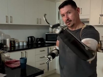 Father-of-two Adam Smith will soon receive prosthetic arms that run of sensors in the muscle.