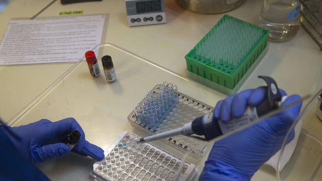 A cluster at Cairns Hospital is believed to have started in the facility’s pathology lab. Picture: Karen Ducey/Getty Images/AFP