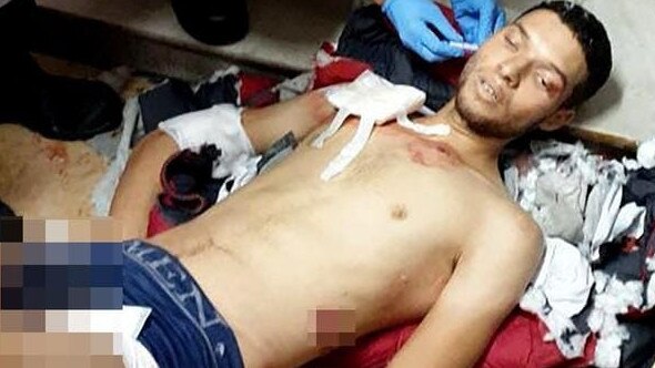 The knifeman, Brahim Aouissaoui, after he was shot by police. Picture: BackGrid