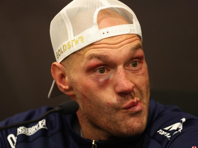 RIYADH, SAUDI ARABIA - MAY 18: Tyson Fury speaks to the media during a post fight press conference following defeat in the IBF, WBA, WBC, WBO and Undisputed Heavyweight titles' fight between Tyson Fury and Oleksandr Usyk at Kingdom Arena on May 18, 2024 in Riyadh, Saudi Arabia. (Photo by Richard Pelham/Getty Images)