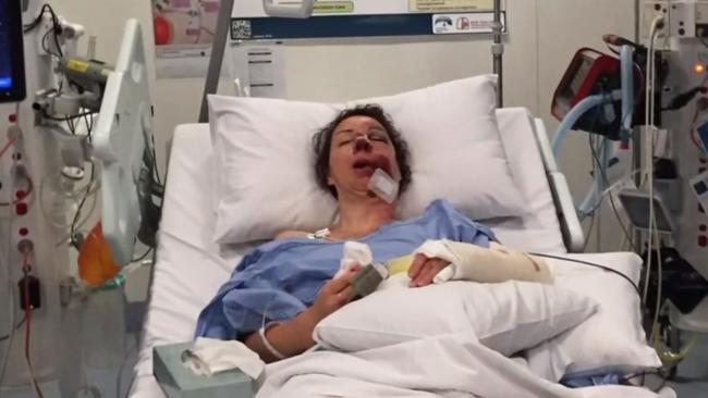 Ms Maus was left for dead on the roadside and her husband has now become her carer. Picture: 7 NEWS Adelaide