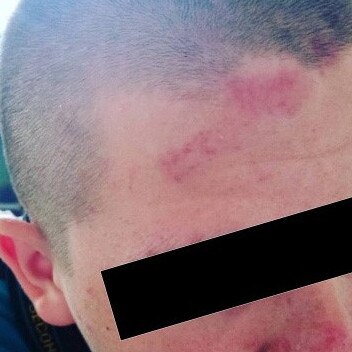 A 14-year-old boy was injured after he was assaulted at a Townsville school. His mum said the school failed to inform her about the incident. PICTURE: SUPPLIED