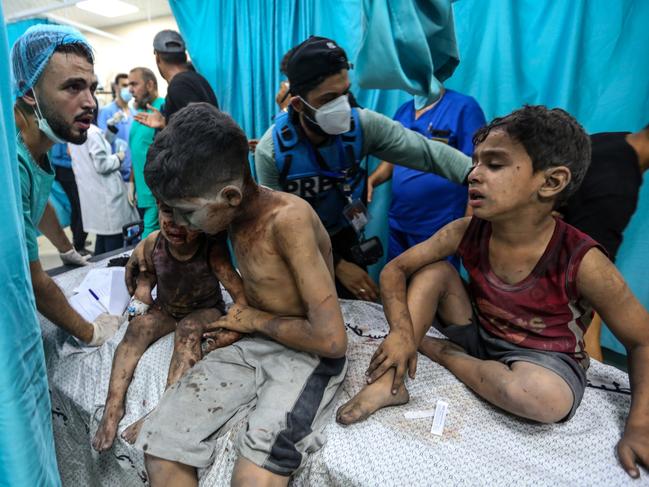 Palestinian children injured in Israeli air raids arrive at Nasser Medical Hospital in Khan Yunis, in the southern Gaza Strip, Gaza. Picture: Getty Images