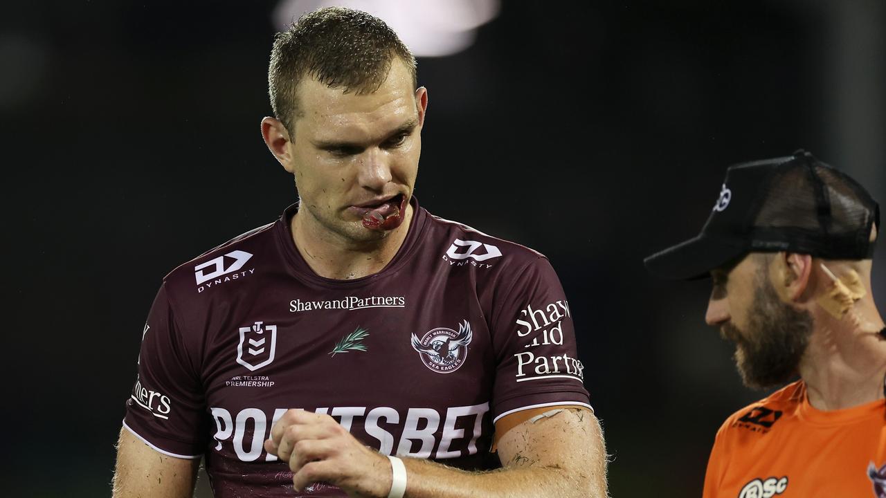 SYDNEY, AUSTRALIA - APRIL 23: Tom Trbojevic of the Sea Eagles leave the field with the trainer during the round eight NRL match between Wests Tigers and Manly Sea Eagles at Campbelltown Stadium on April 23, 2023 in Sydney, Australia. (Photo by Mark Kolbe/Getty Images)