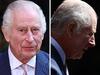 ‘Shock’: King lifts lid on cancer discovery