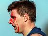 ‘Embarrassing’: Horror clash left concussion victim in disbelief