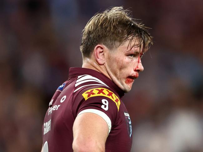 Harry Grant was left bloodied and bruised after the Leniu collision. (Photo by Chris Hyde/Getty Images)