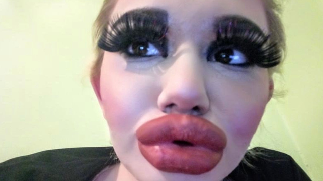 Andrea Ivanova Has 17 Lip Injections To Look Like Idol Barbie Herald Sun 
