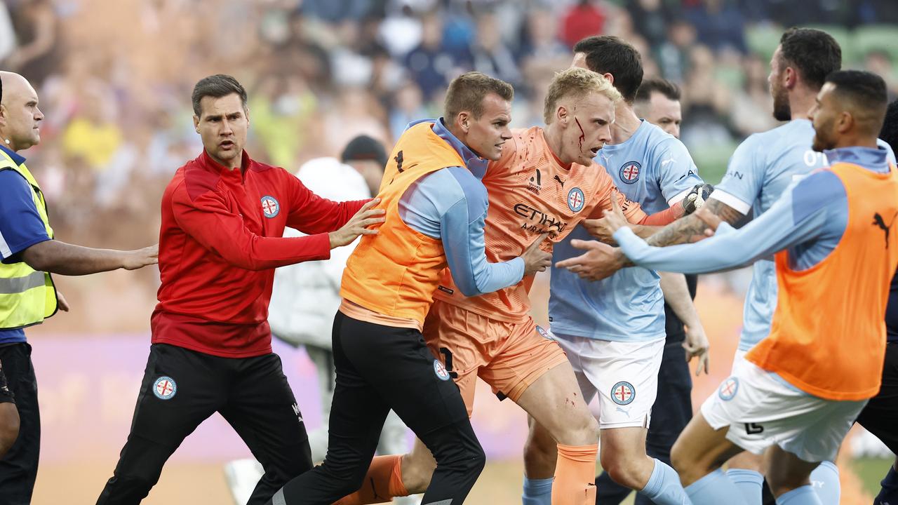 A bleeding Tom Glover of Melbourne City is escorted from the pitch by teammates after fans stormed the pitch during the round eight A-League Men's match between Melbourne City and Melbourne Victory. (Photo by Darrian Traynor/Getty Images)