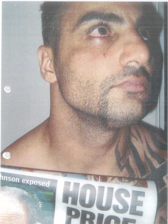 Mick Hawi took photos of his injuries with a copy of the paper.