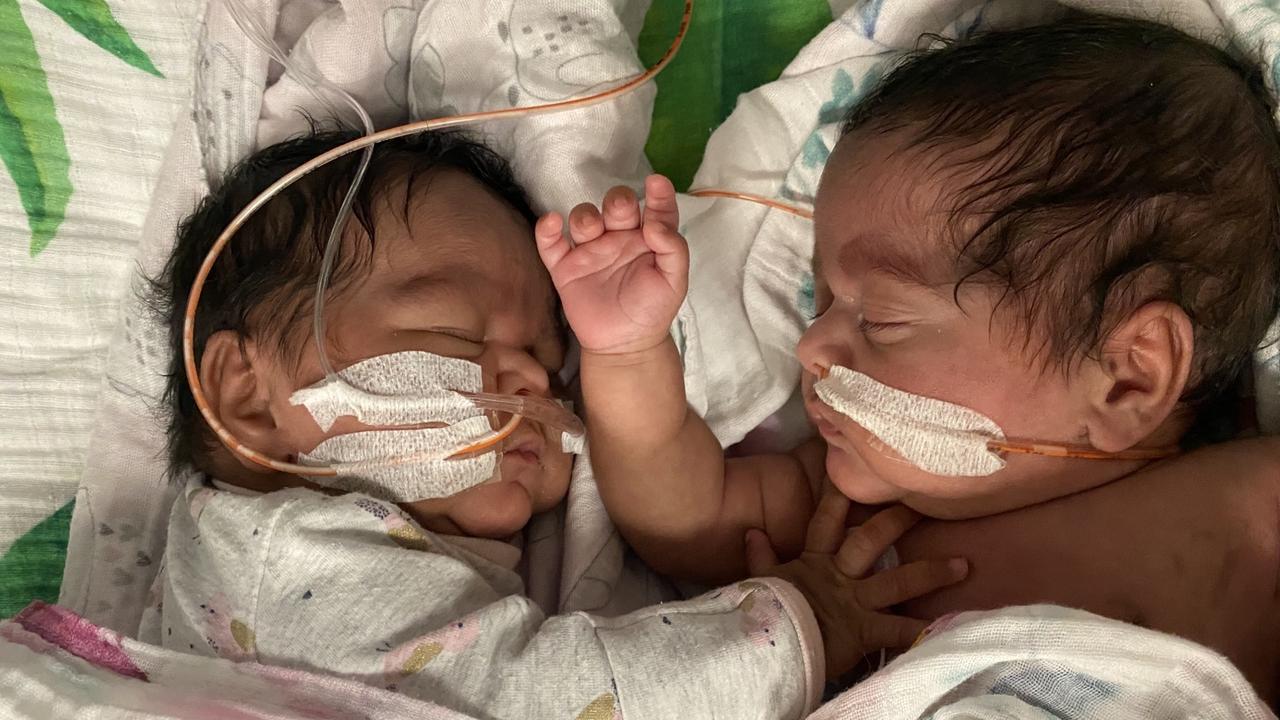 The “miracle” babies arrived four months early. Picture: Supplied