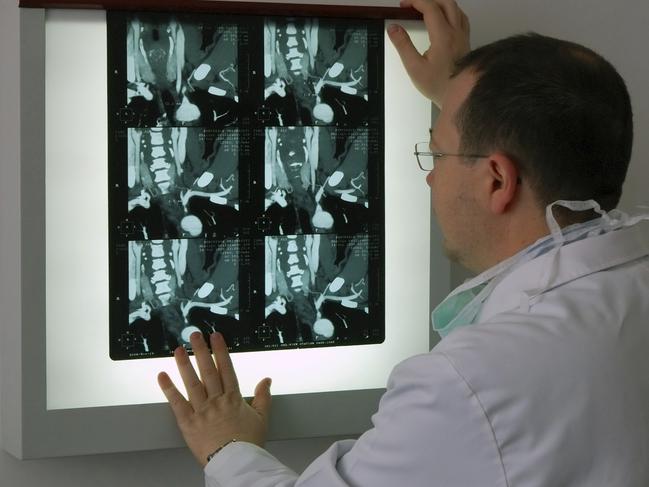 Generic photo in hospital - doctor looking at an xray (x-ray).  Picture: iStock