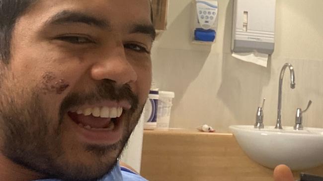 MMA fighter Daniel Williams, also known as Mini T, is recovering in hospital learning how to walk again after a car crash almost claimed his life. Picture: Instagram